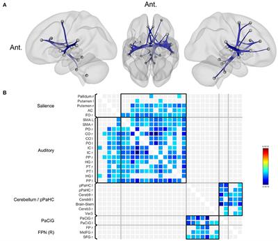 Functional and anatomical alterations in bilateral vestibulopathy: A multimodal neuroimaging study and clinical correlation